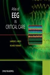 Book cover of Atlas of EEG in Critical Care by Lawrence J. Hirsch