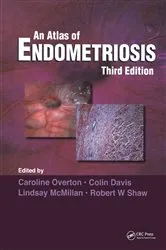 Book cover of Atlas of Endometriosis (3rd ed.) by Caroline Overton
