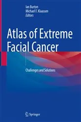 Book cover of Atlas of Extreme Facial Cancer by Ian Burton