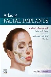 Book cover of Atlas of Facial Implants E-Book (2nd ed.) by Michael J. Yaremchuk MD