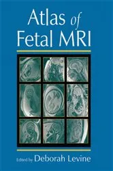 Book cover of Atlas of Fetal MRI by Deborah Levine