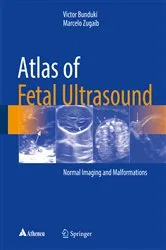 Book cover of Atlas of Fetal Ultrasound by Victor Bunduki