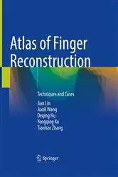 Book cover of Atlas of Finger Reconstruction by Jian Lin