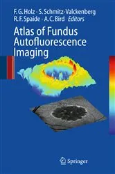 Book cover of Atlas of Fundus Autofluorescence Imaging by Frank G. Holz