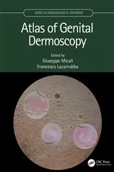 Book cover of Atlas of Genital Dermoscopy by Giuseppe Micali