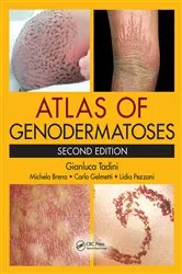 Book cover of Atlas of Genodermatoses (2nd ed.) by Gianluca Tadini