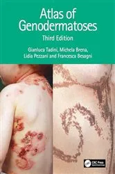 Book cover of Atlas of Genodermatoses (3rd ed.) by Gianluca Tadini