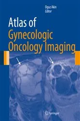 Book cover of Atlas of Gynecologic Oncology Imaging by Oguz Akin