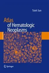 Book cover of Atlas of Hematologic Neoplasms by Tsieh Sun