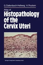 Book cover of Atlas of Histopathology of the Cervix Uteri by Gisela Dallenbach-Hellweg