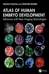 Book cover of Atlas of Human Embryo Development by Nicolas Plachta