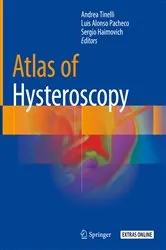 Book cover of Atlas of Hysteroscopy by Andrea Tinelli