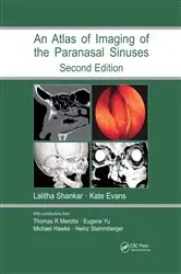 Book cover of Atlas of Imaging of the Paranasal Sinuses, Second Edition (2nd ed.) by Lalitha Shankar
