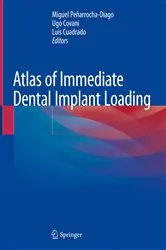 Book cover of Atlas of Immediate Dental Implant Loading by Miguel Peñarrocha-Diago