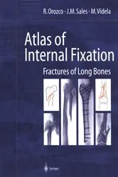 Book cover of Atlas of Internal Fixation by Unknown