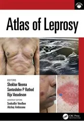 Book cover of Atlas of Leprosy by Shekhar Neema