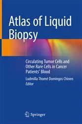 Book cover of Atlas of Liquid Biopsy by Unknown