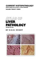 Book cover of Atlas of Liver Pathology (2nd ed.) by D.G. Wight