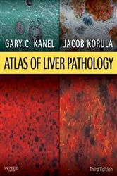 Book cover of Atlas of Liver Pathology E-Book (3rd ed.) by Gary C. Kanel MD