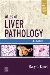 Book cover of Atlas of Liver Pathology - E-Book (4th ed.) by Gary C. Kanel MD