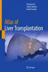 Book cover of Atlas of Liver Transplantation by Chetana Lim