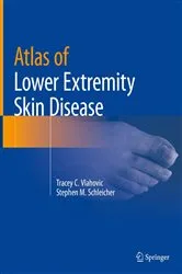 Book cover of Atlas of Lower Extremity Skin Disease by Tracey C. Vlahovic