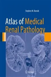 Book cover of Atlas of Medical Renal Pathology by Stephen M. Bonsib