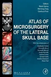 Book cover of Atlas of Microsurgery of the Lateral Skull Base by Mario Sanna
