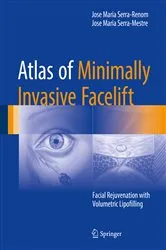 Book cover of Atlas of Minimally Invasive Facelift by Jose Maria Serra-Renom