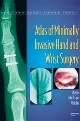 Book cover of Atlas of Minimally Invasive Hand and Wrist Surgery by John T. Capo
