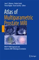 Book cover of Atlas of Multiparametric Prostate MRI by Joan C. Vilanova