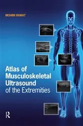 Book cover of Atlas of Musculoskeletal Ultrasound of the Extremities by Mohini Rawat