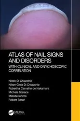 Book cover of Atlas of Nail Signs and Disorders with Clinical and Onychoscopic Correlation by Nilton Di Chiacchio
