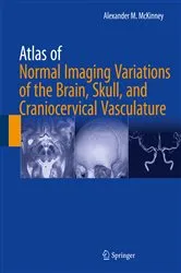 Book cover of Atlas of Normal Imaging Variations of the Brain, Skull, and Craniocervical Vasculature by Alexander M. McKinney
