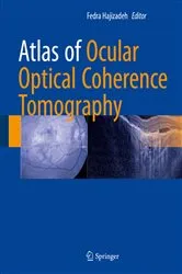 Book cover of Atlas of Ocular Optical Coherence Tomography by Fedra Hajizadeh
