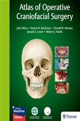 Book cover of Atlas of Operative Craniofacial Surgery by Unknown