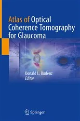 Book cover of Atlas of Optical Coherence Tomography for Glaucoma by Donald L. Budenz