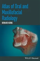 Book cover of Atlas of Oral and Maxillofacial Radiology by Bernard Koong
