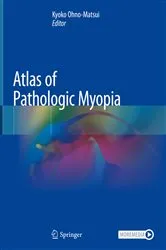 Book cover of Atlas of Pathologic Myopia by Kyoko Ohno-Matsui