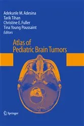 Book cover of Atlas of Pediatric Brain Tumors by Adekunle M. Adesina