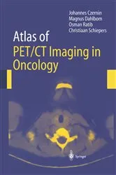 Book cover of Atlas of PET/CT Imaging in Oncology by Johannes Czernin