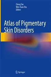 Book cover of Atlas of Pigmentary Skin Disorders by Cheng Tan
