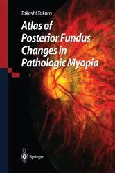 Book cover of Atlas of Posterior Fundus Changes in Pathologic Myopia by Takashi Tokoro