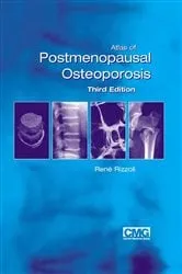 Book cover of Atlas of Postmenopausal Osteoporosis (3rd ed.) by Rene Rizzoli