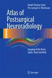 Book cover of Atlas of Postsurgical Neuroradiology by Daniel Thomas Ginat