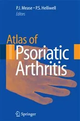 Book cover of Atlas of Psoriatic Arthritis by Philip J. Mease