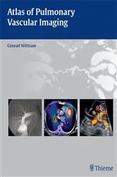 Book cover of Atlas of Pulmonary Vascular Imaging by Conrad Wittram