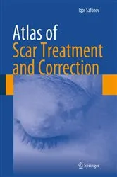 Book cover of Atlas of Scar Treatment and Correction by Igor Safonov