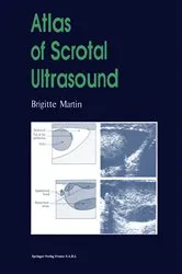 Book cover of Atlas of Scrotal Ultrasound by Brigitte Martin