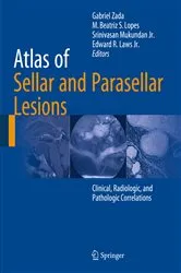 Book cover of Atlas of Sellar and Parasellar Lesions by Gabriel Zada